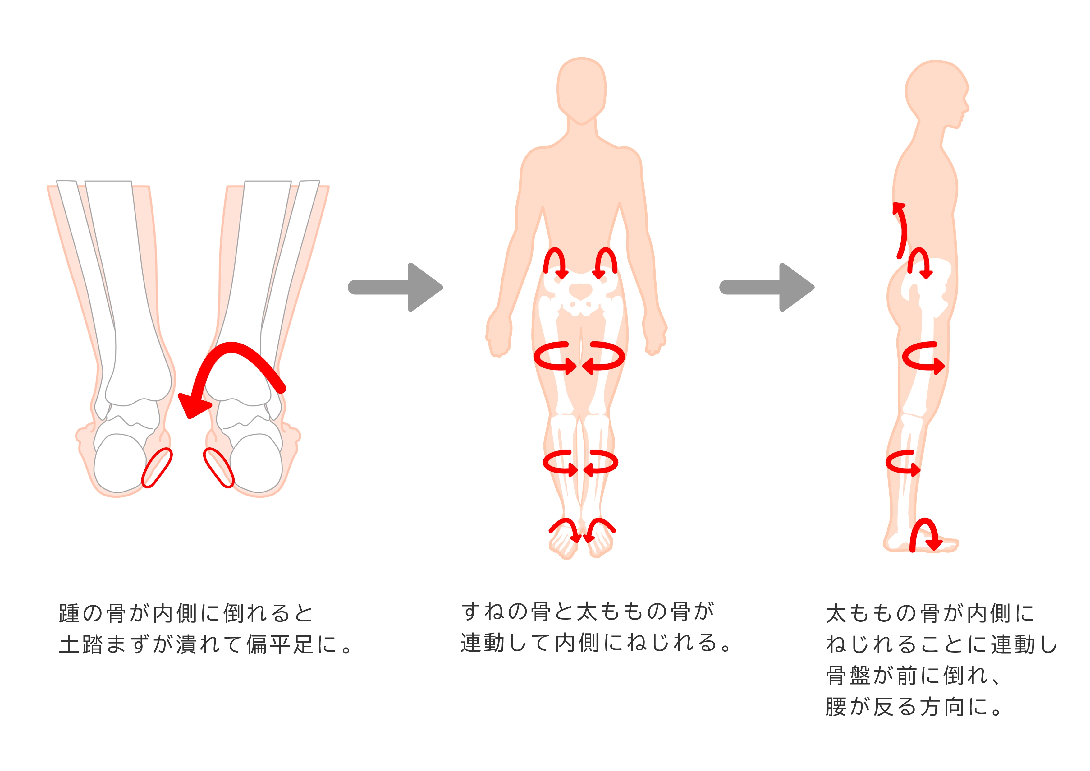 腰 が 痛い トップ 靴